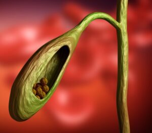 yumel para calculos biliares